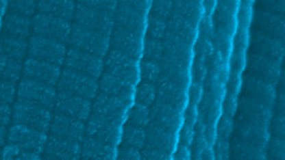 an electron microscopy image of collagen coloured blue showing the globular structure of the protein